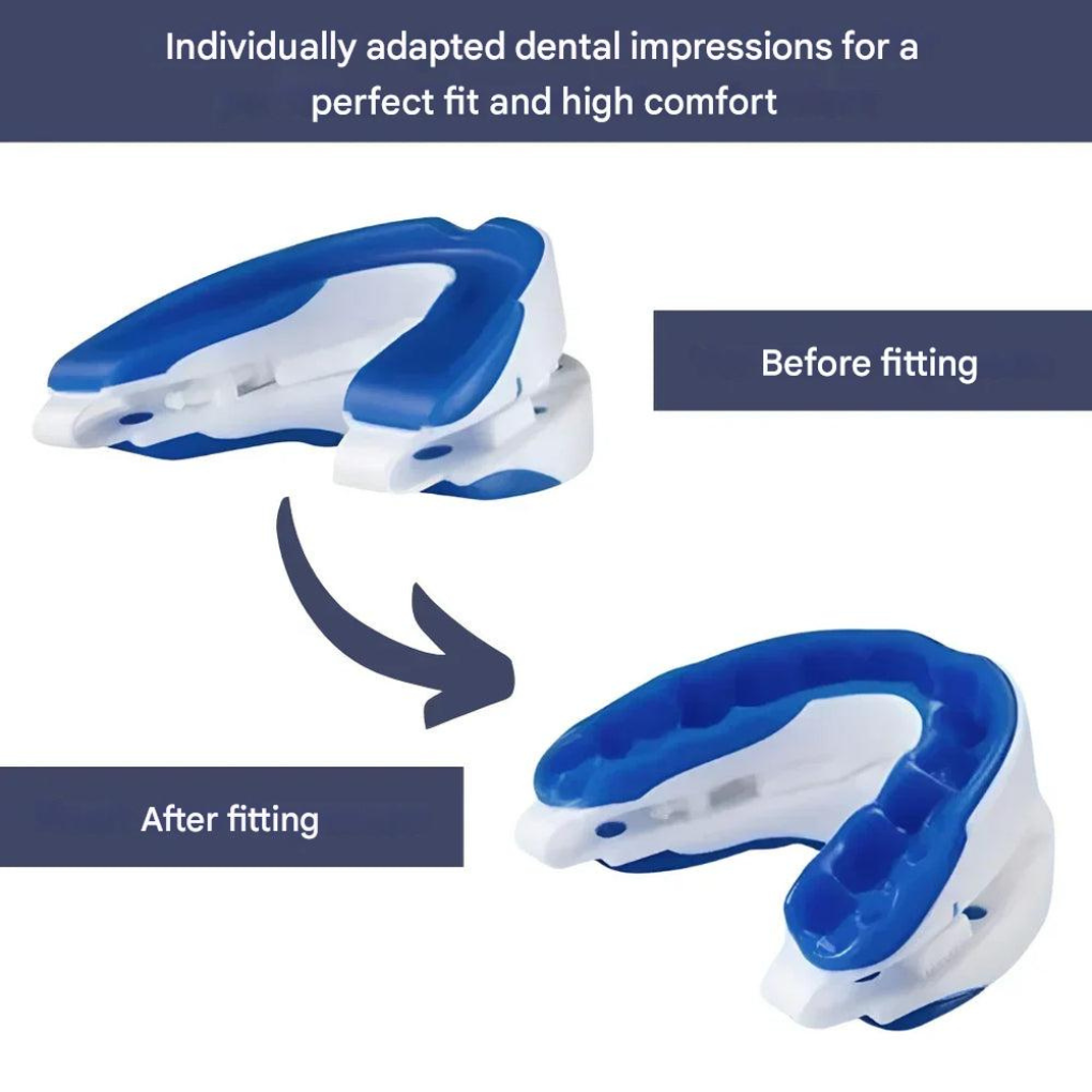 Stop Snoring Sleep Aid Device - Vossary